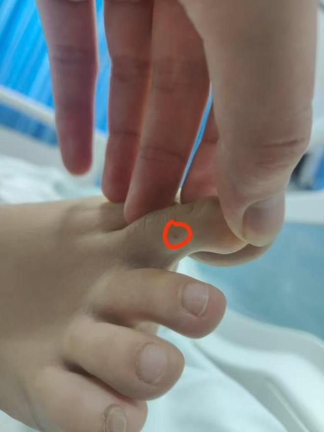 甲医院面对常见蛇伤却毫无办法三亚被蛇咬死的美女真冤堂堂三(图5)